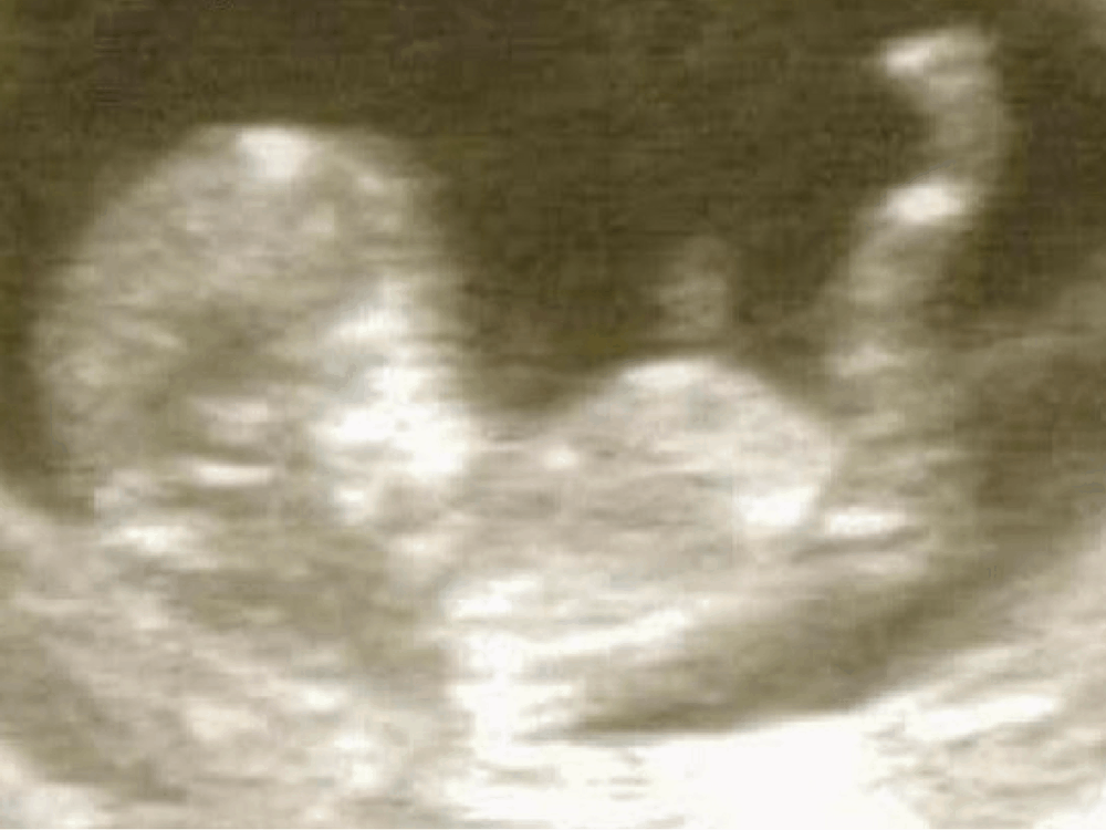 Bible verses about mothers - an ultrasound picture.